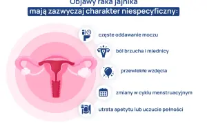 Ilustracja przedstawia narządy rodne kobiety i objawy raka jajnika: ból brzucha, wzdęcia, zmiany cyklu, częste oddawanie moczu, utratę apetytu.