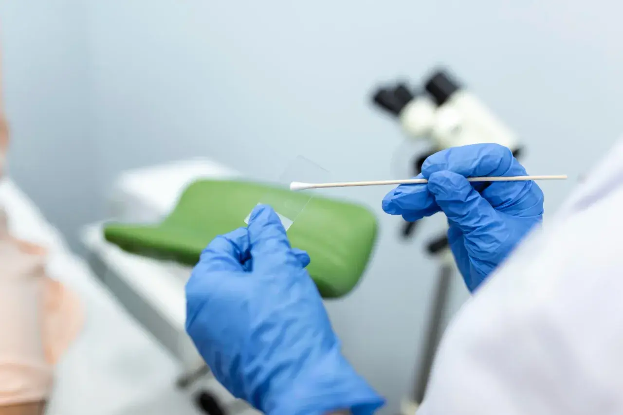 Ręce w niebieskich rękawiczkach przygotowują próbkę do badań cytologia wyniki. W tle mikroskop i fotel ginekologiczny.