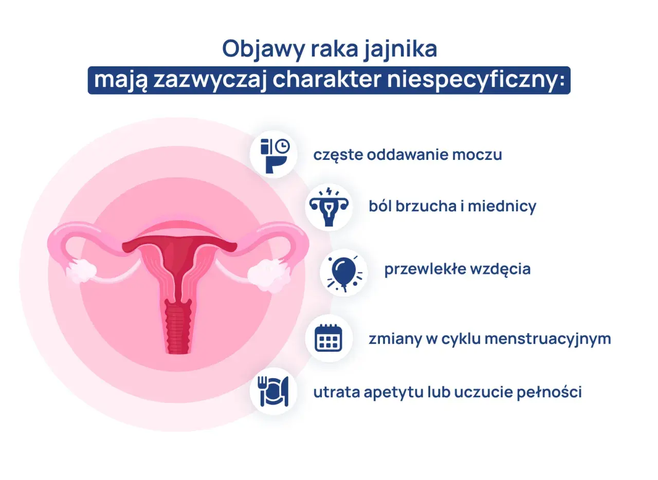 Ilustracja przedstawia narządy rodne kobiety i objawy raka jajnika: ból brzucha, wzdęcia, zmiany cyklu, częste oddawanie moczu, utratę apetytu.