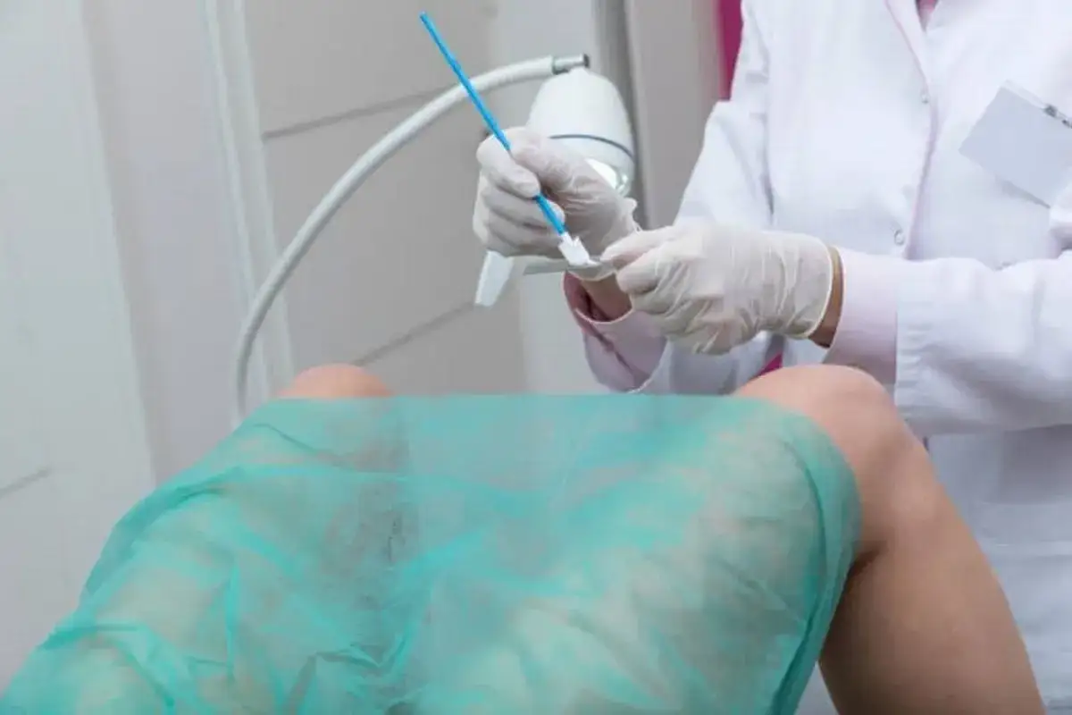 Lekarz przygotowuje się do pobrania wymazu do testu na HPV.