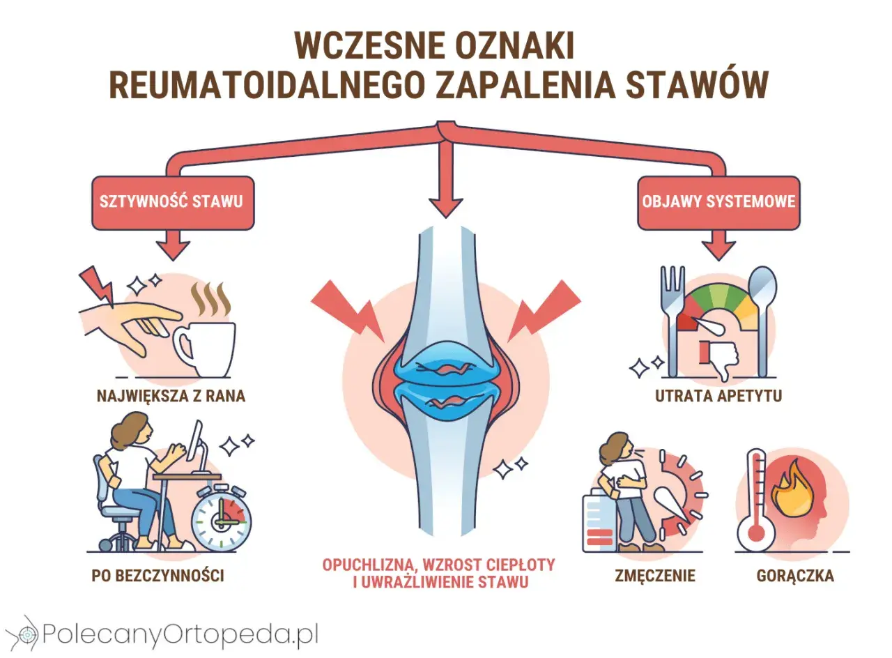 Wczesne objawy RZS: sztywność stawów, ból po bezczynności, opuchlizna, utrata apetytu, zmęczenie, gorączka. To sygnały, co na stawy.